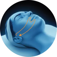 EMface facial toning London - 3D head diagram showing the lower cheeks 3D head diagram showing the lower cheeks for EMface facial toning in London