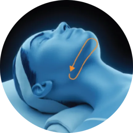 3D head diagram showing the area under the chin for EMface facial toning in London